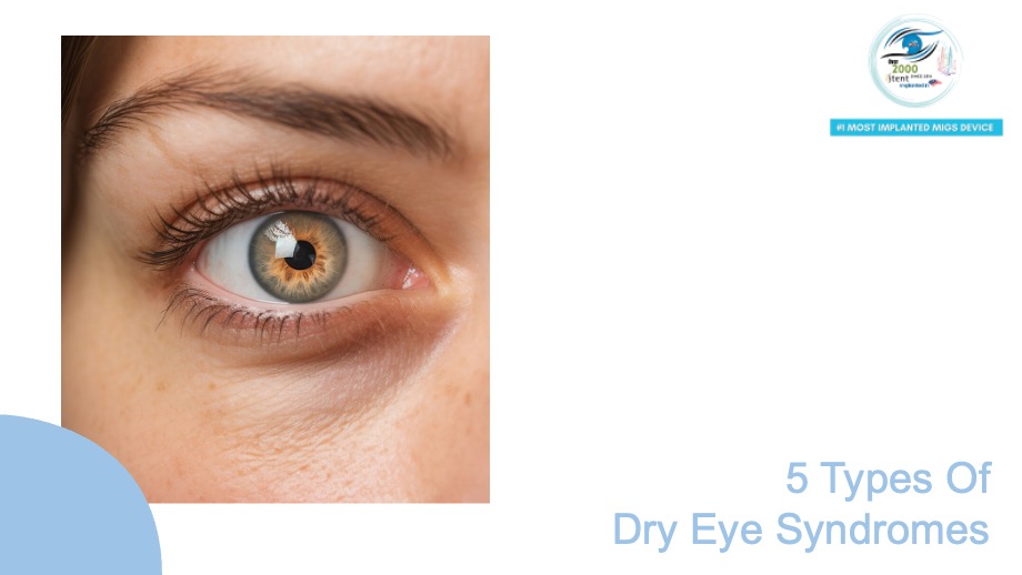 5 Types Of Dry Eye Syndromes